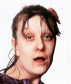 kathy burke